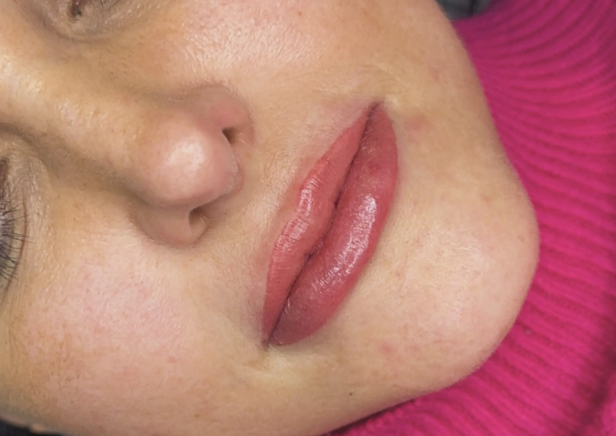 lip neutralization